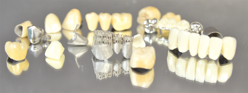 metal detekli protez diş